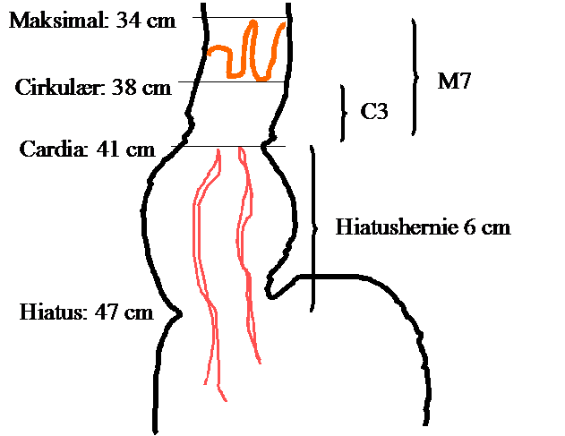 BE